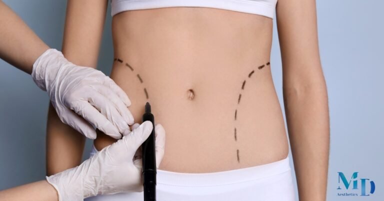 Liposuction: Precision Body Sculpting for Stubborn Fat Areas